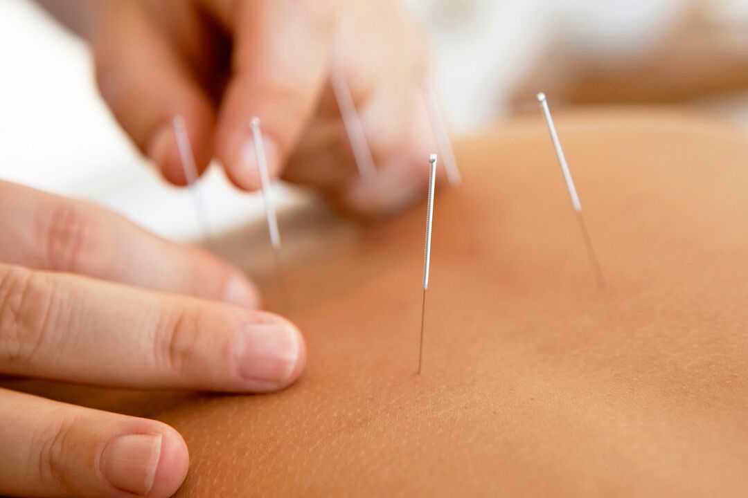 akupunktúra a potencia növelésére